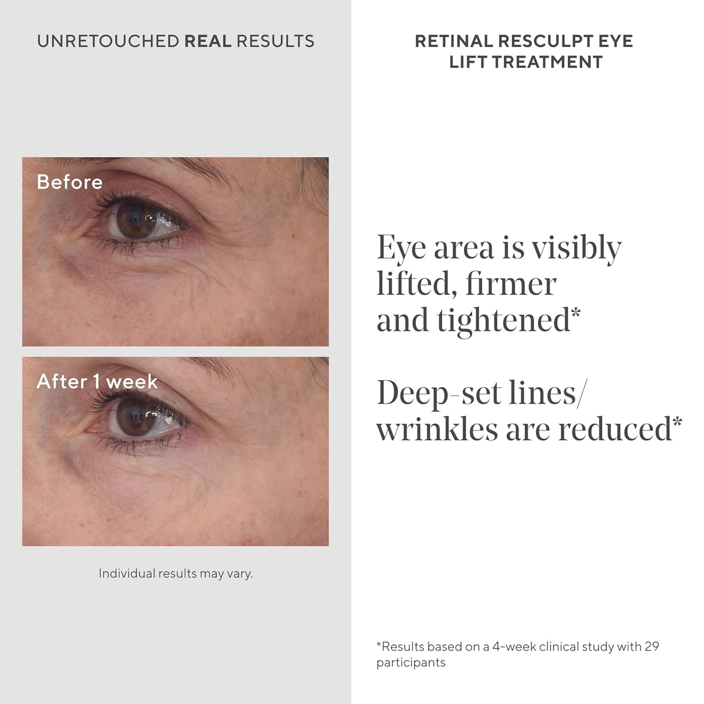 Murad Retinal ReSculpt Eye Lift - Anti-Aging Treatment, Firms Droopy Eyelids, 0.5 FL OZ