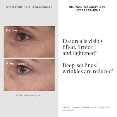 Murad Retinal ReSculpt Eye Lift - Anti-Aging Treatment, Firms Droopy Eyelids, 0.5 FL OZ