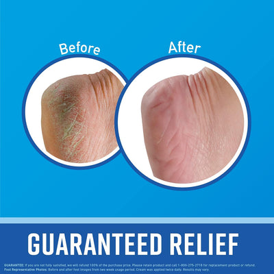 O'Keeffe's Healthy Feet Cream - Guaranteed Relief for Dry, Cracked Feet, 6.4 oz (Pack of 1)