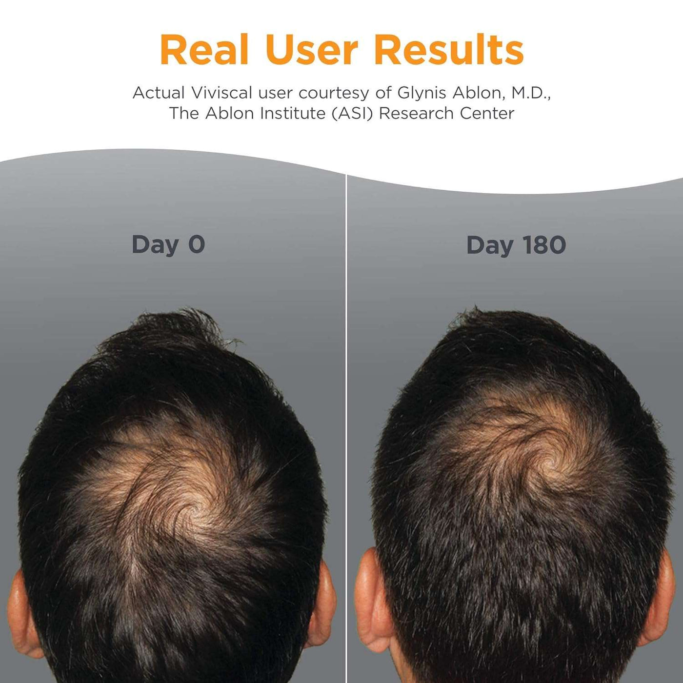 Viviscal Men's Hair Growth Supplements - Clinically Proven, Collagen Complex, 180 Tablets - 3 Month Supply
