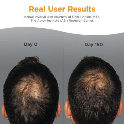 Viviscal Men's Hair Growth Supplements - Clinically Proven, Collagen Complex, 180 Tablets - 3 Month Supply