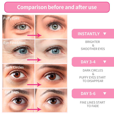 BREYLEE Rose Eye Mask– 60 Pcs, Under Eye Patches,Eye Patches For Puffy Eyes,Hydrates, Improves And Firms The Eye Area, Suitable For Both Women And Men.