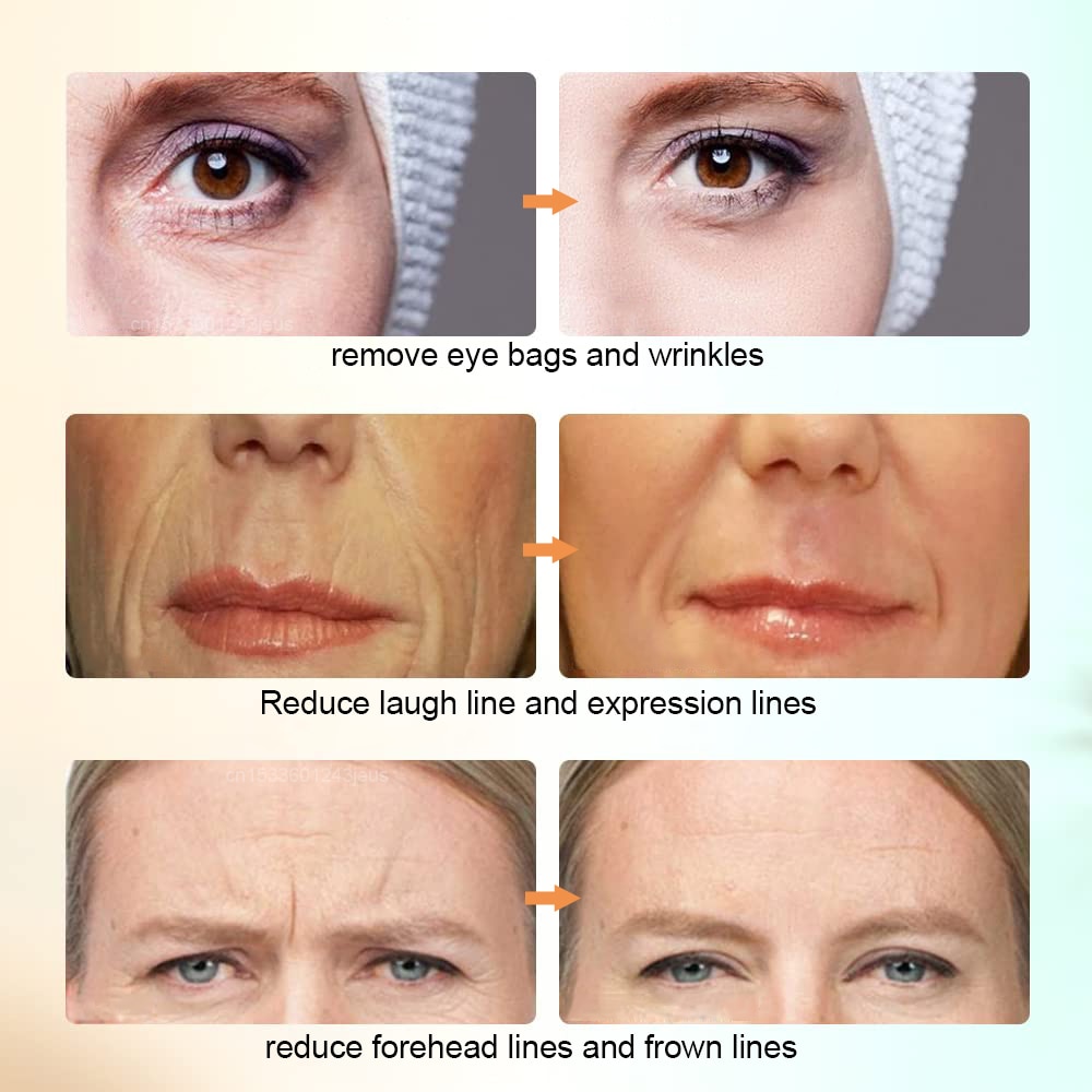 Skin Tightening Machine Face Lifting Device For Wrinkle Anti Aging EMS Skin Rejuvenation Radio Frequency Facial Massager